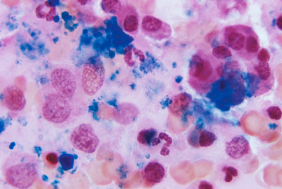 Studio macro photograph of bone marrow